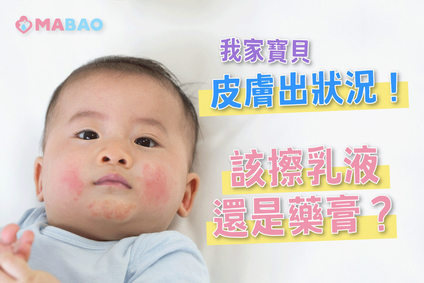 嬰兒過敏紅疹擦什麼藥膏好?安全用藥指南分享!