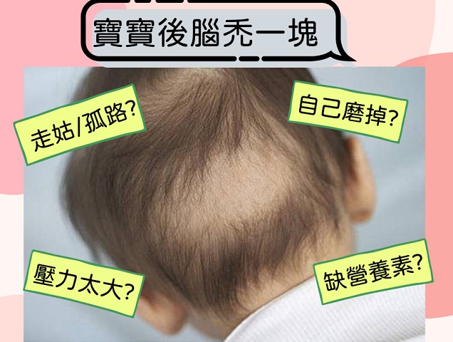 嬰兒姑路怎麼舒緩?專家教你正確應對方法!