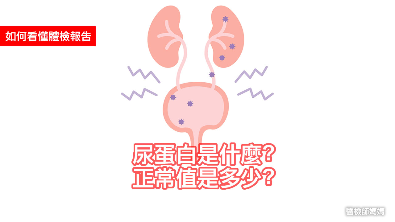 懷孕尿蛋白正常值是多少?超過這個數值要小心!