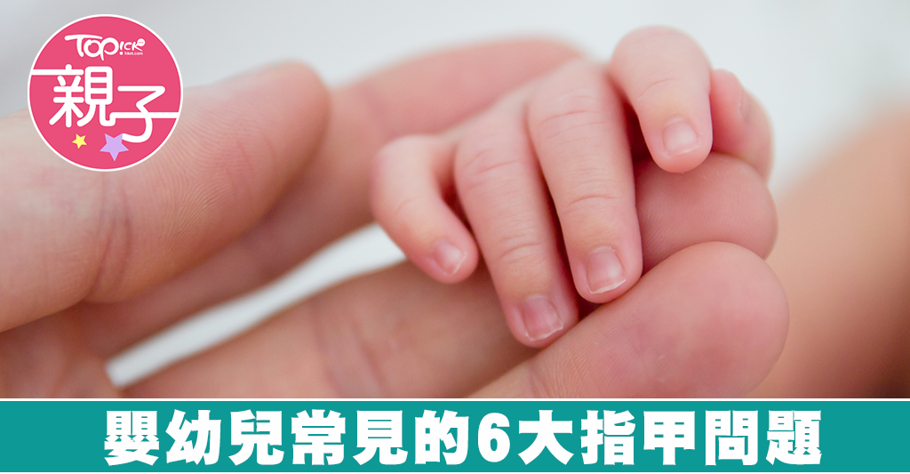 嬰兒指甲形狀異常怎麼辦?教你判斷與處理!