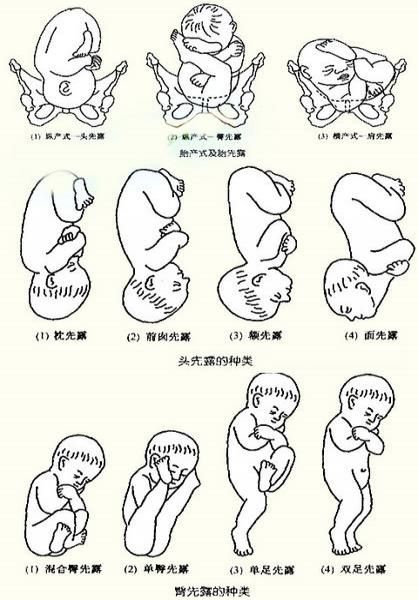 胎兒姿勢代表什麼?帶你了解寶寶的健康密碼!