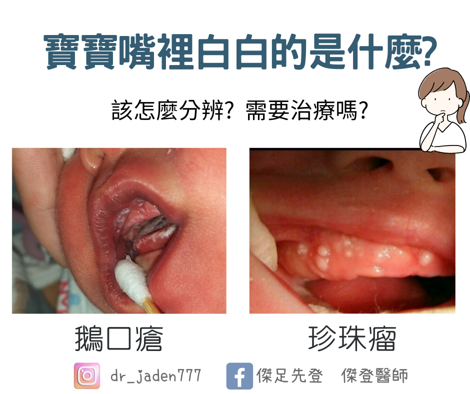 嬰兒牙齦白白的要看醫生嗎?出現這些狀況快就醫!