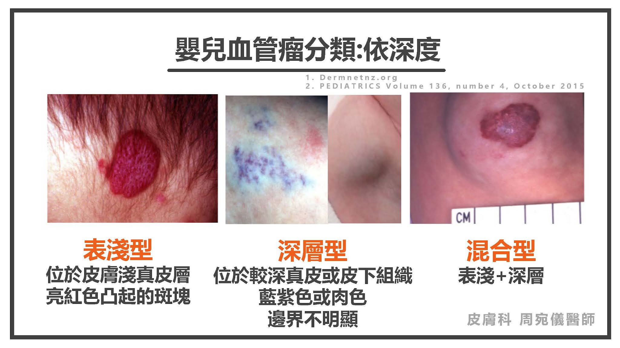 新生兒血管瘤照片大公開!教你一眼辨識類型!