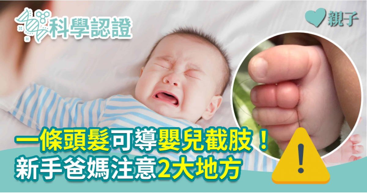 嬰兒頭髮禿一塊怎麼辦?新手爸媽必看照護指南!