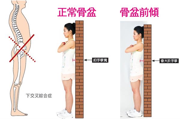 子宮前傾怎麼辦?別擔心,簡單方法教你改善!