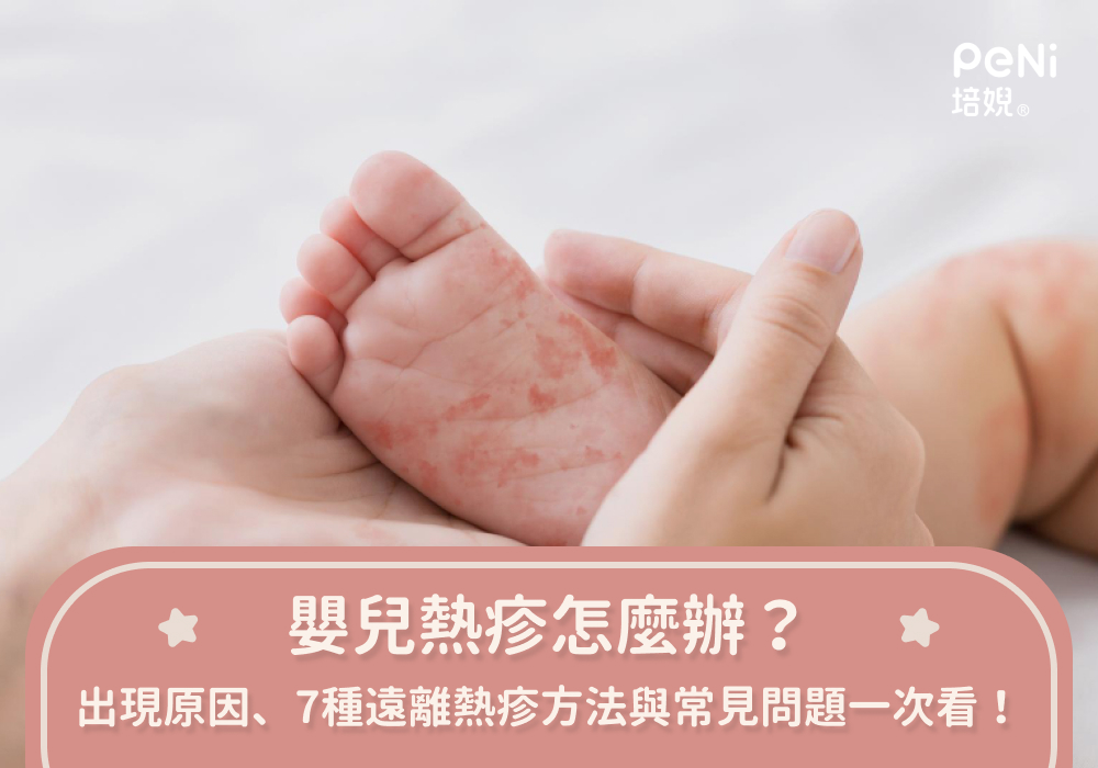 新生兒熱疹多久會好?搞懂原因與處理方法告別紅疹!