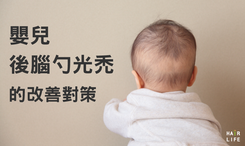 嬰兒頭髮禿一塊怎麼辦?新手爸媽必看照護指南!