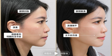 懷孕嘴唇乾裂好困擾?這幾招讓妳水潤嘟嘟唇!